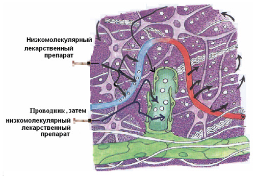 Лимфотропная терапия